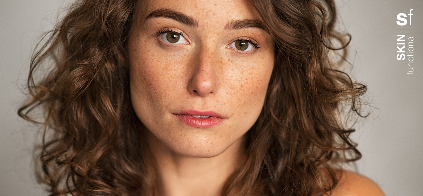 Best products to treat hyperpigmentation