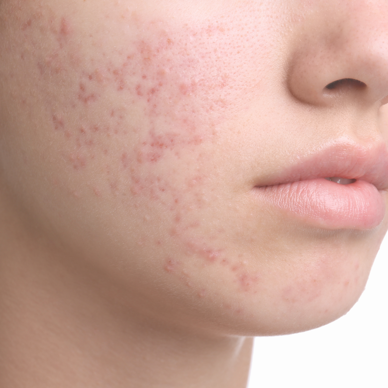 SKIN functional