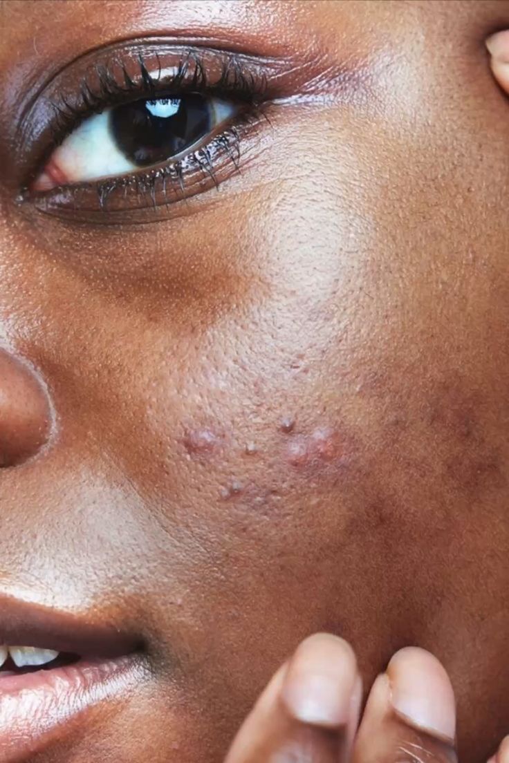 SKIN functional