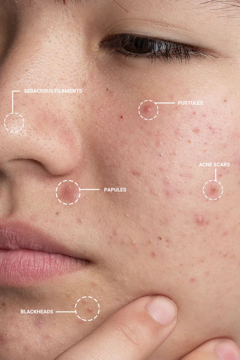 SKIN functional