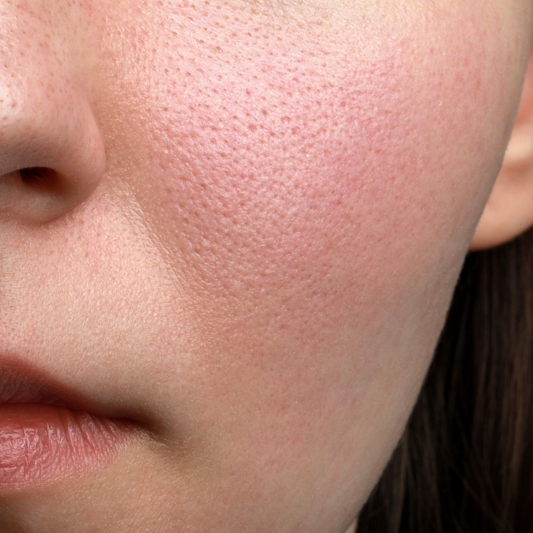 SKIN functional