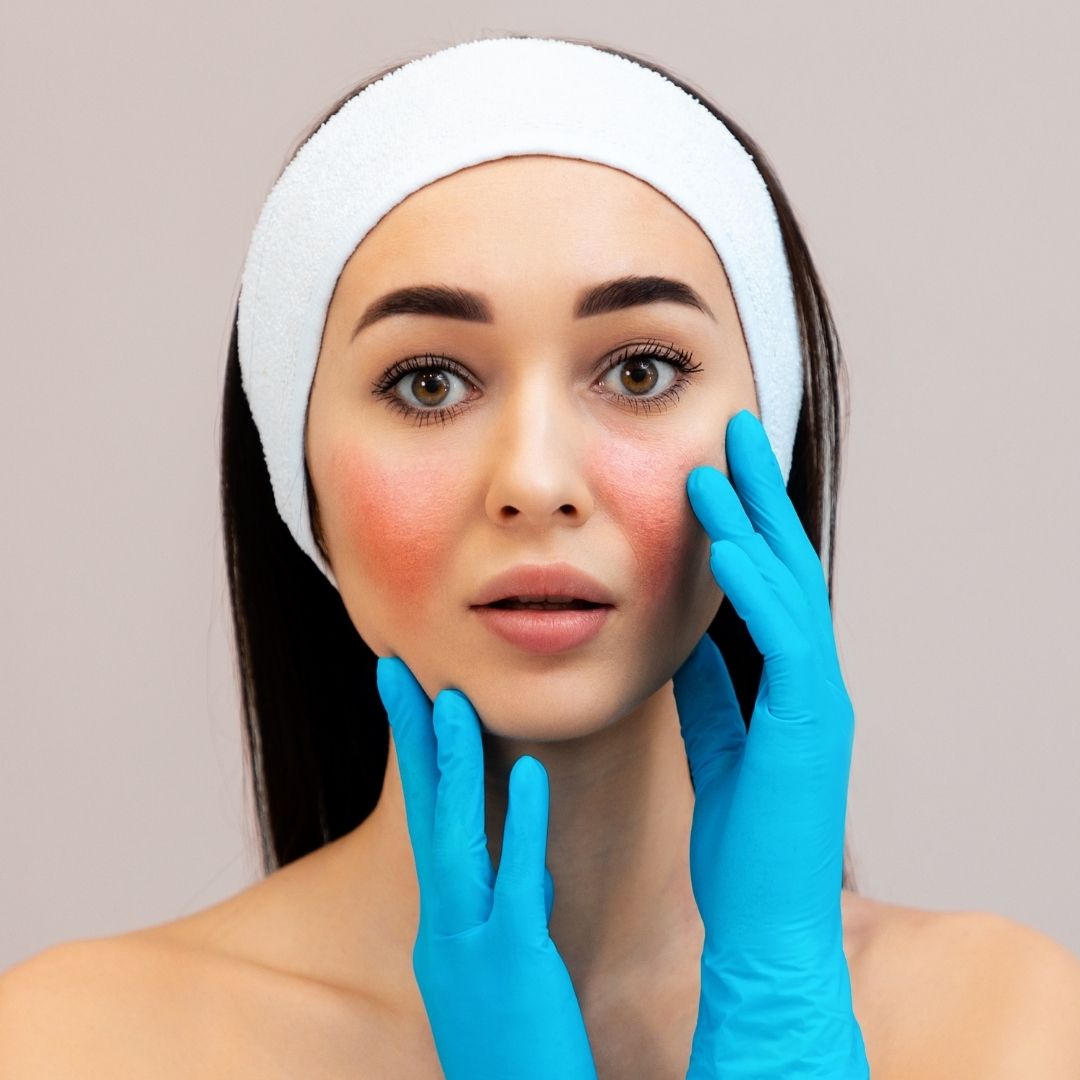 SKIN functional
