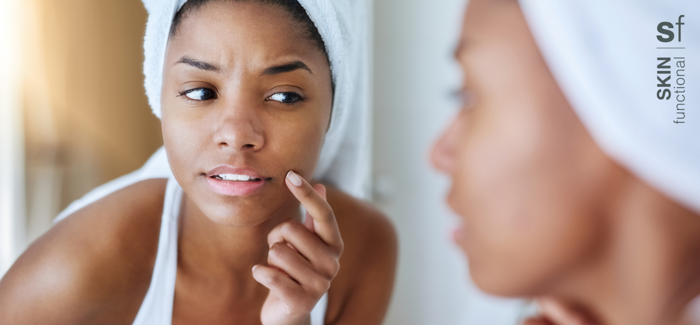 Everything you need to know about breakouts