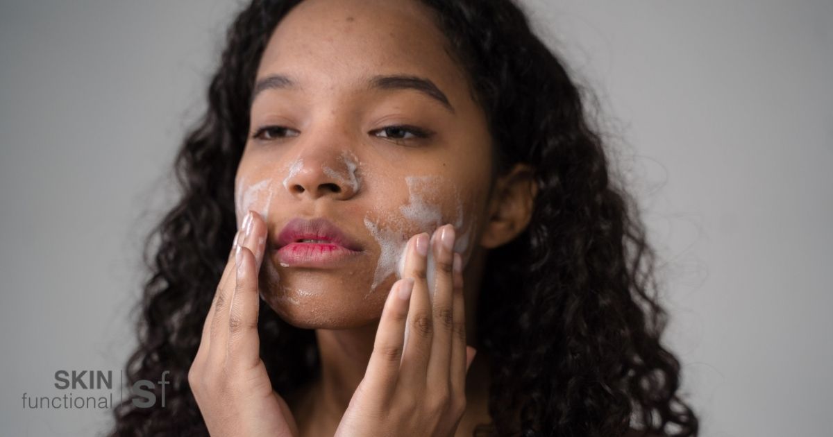 Woman applying a gentle cleanser to her jaw and chin, an area prone to hormonal acne
