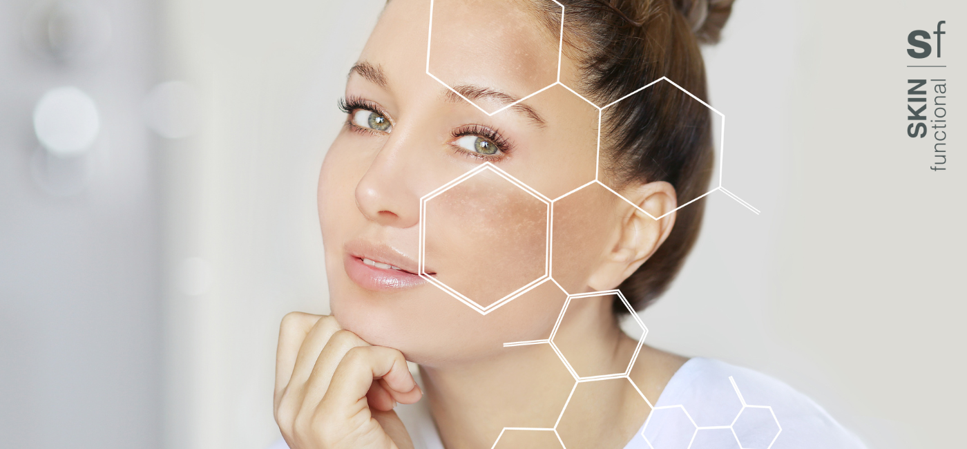 4 common myths about hyperpigmentation