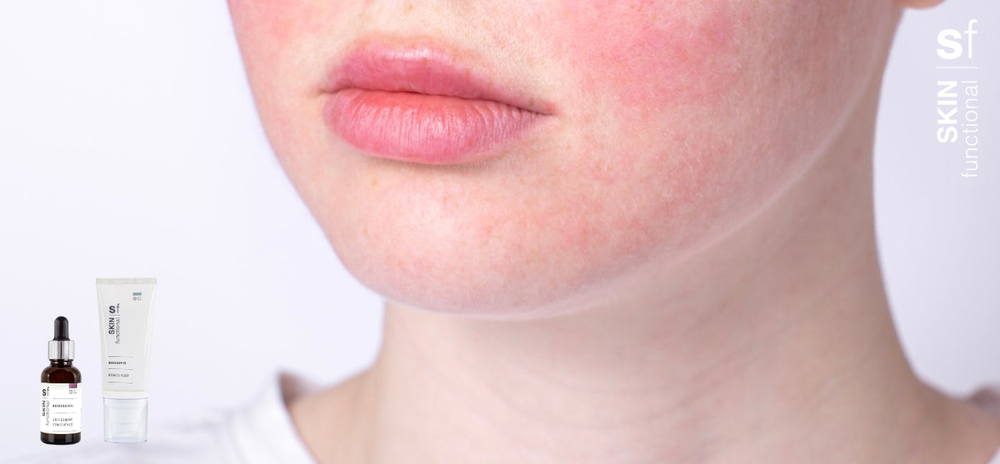 SKIN functional and Dr. Lauren Knight unveil breakthrough skincare innovations for sensitive skin and rosacea