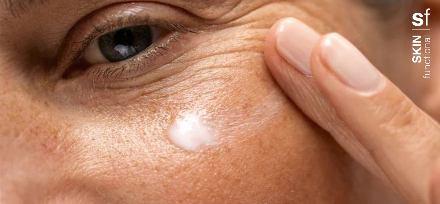 Pigmentation 101: What you need to know