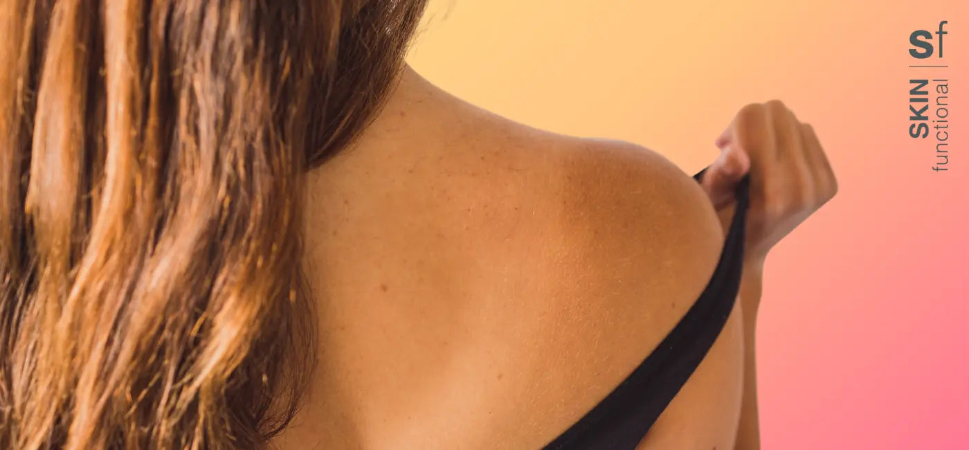 Sun safety in 5 easy steps