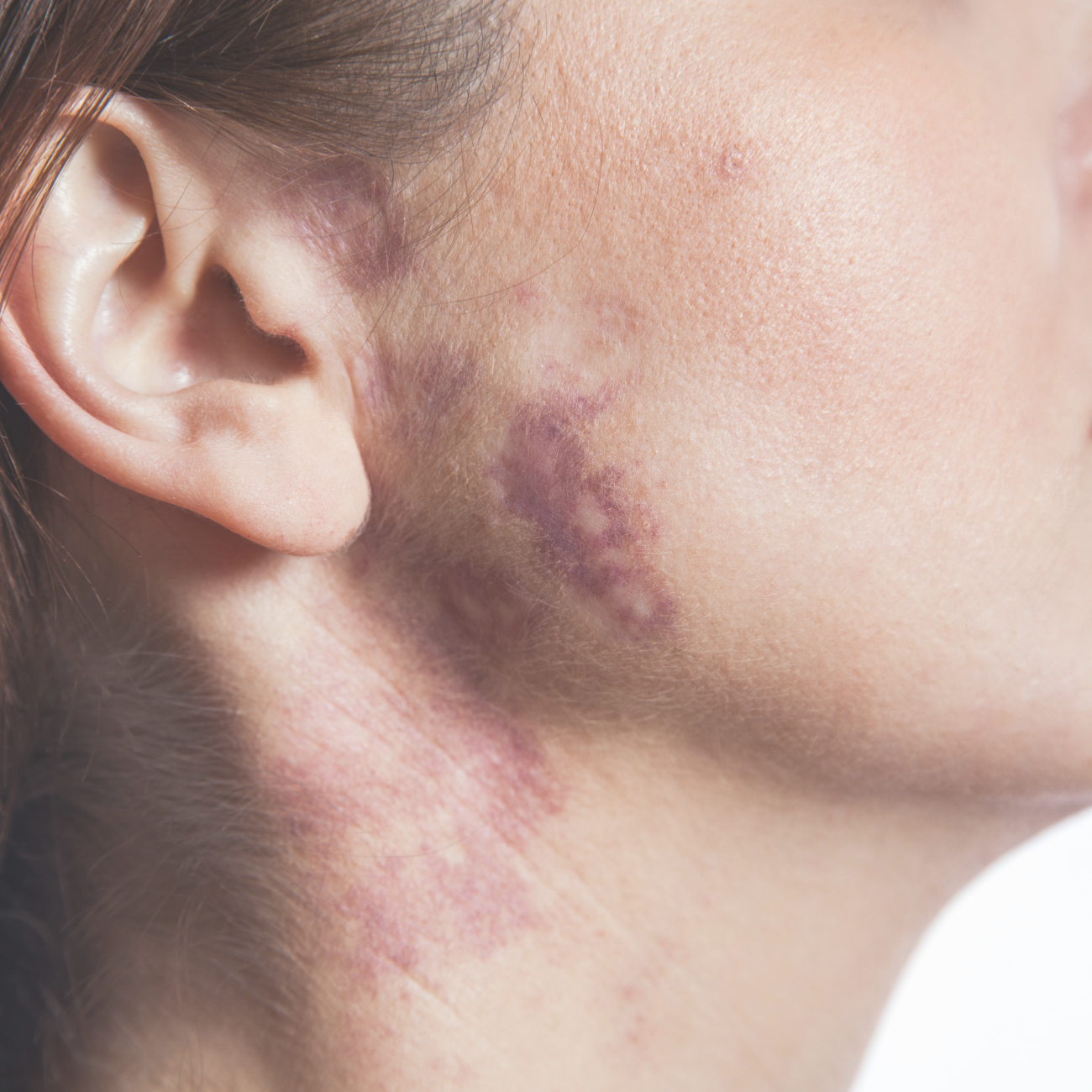 SKIN functional