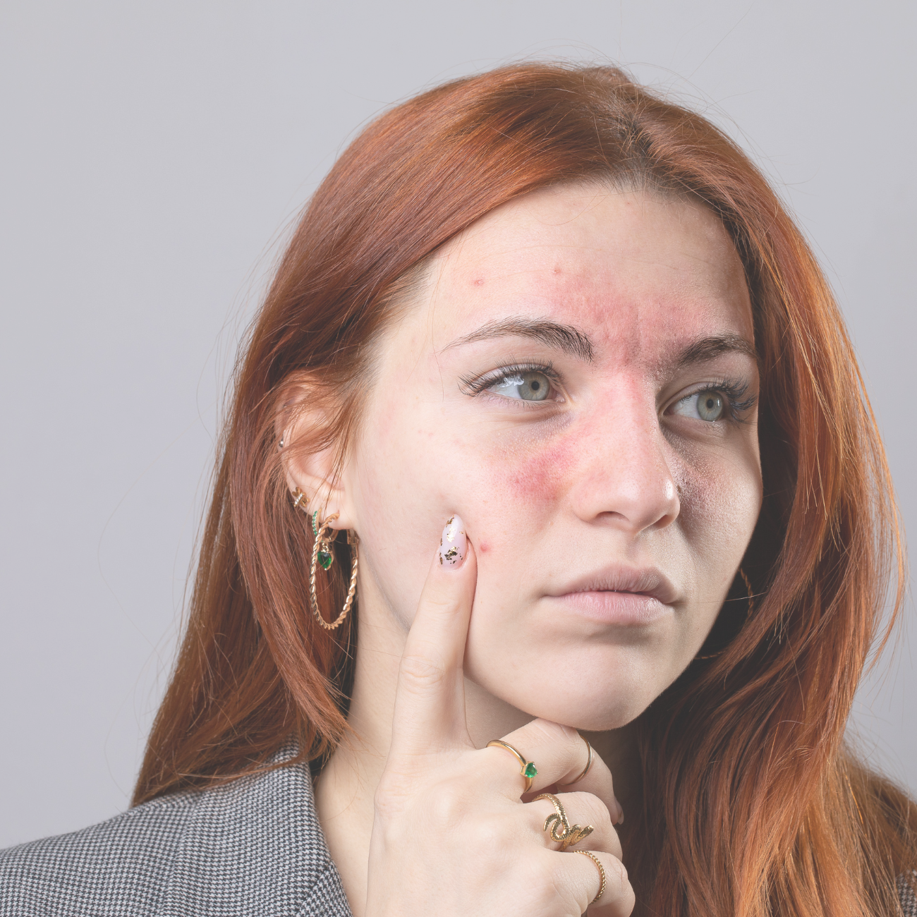 SKIN functional