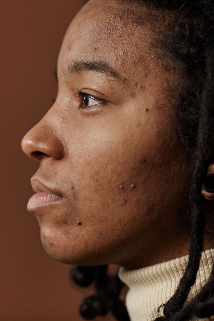 Close-up of a person with braided hair against a brown background