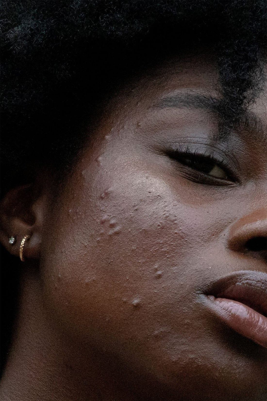 Close-up Of A Person's Face With Visible Skin Texture