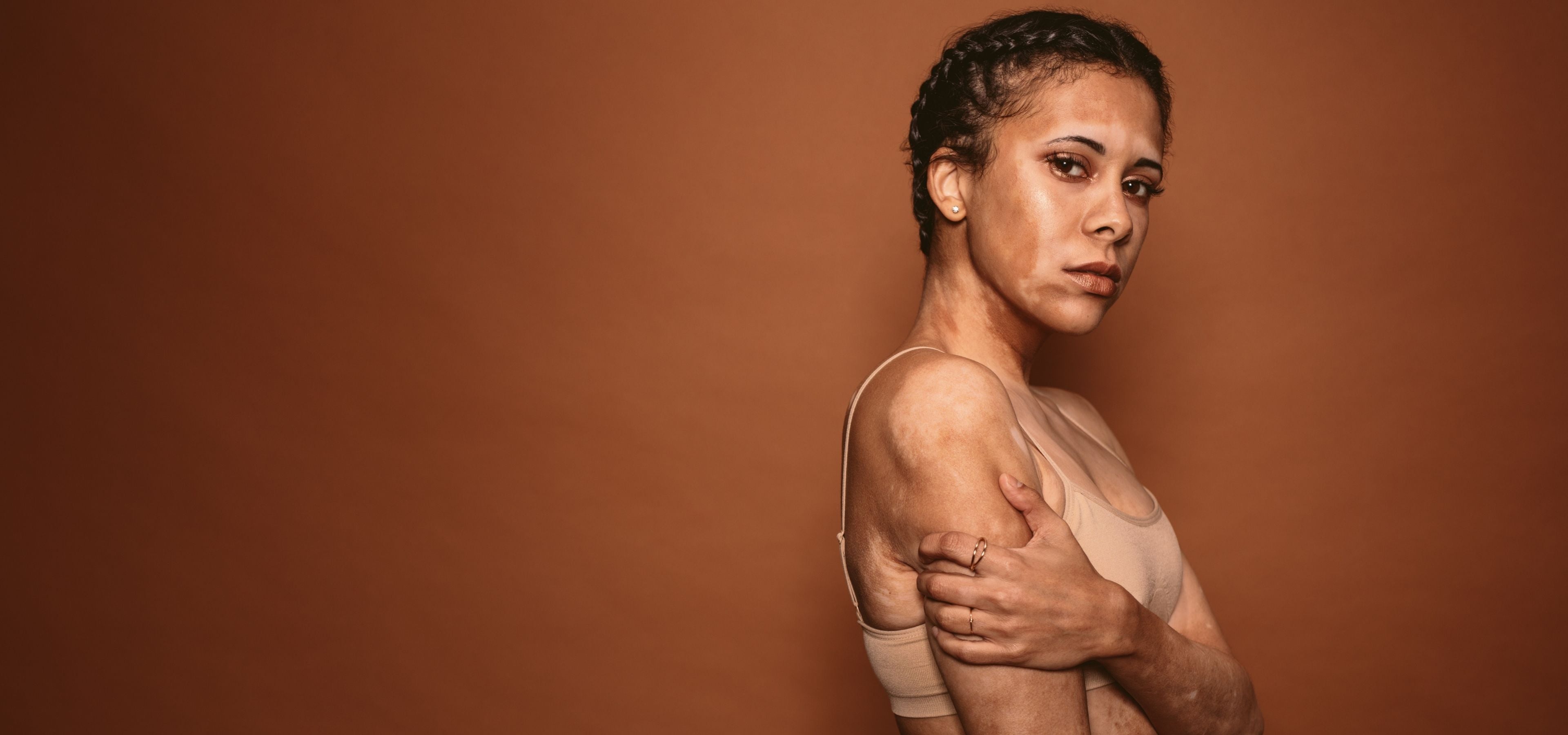 Skin_Functional_Women_With_PigmentationSkincare_Product_Face_Products